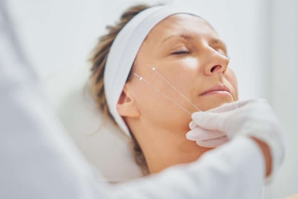 10 Reasons Why You Should Get a Threadlift Treatment