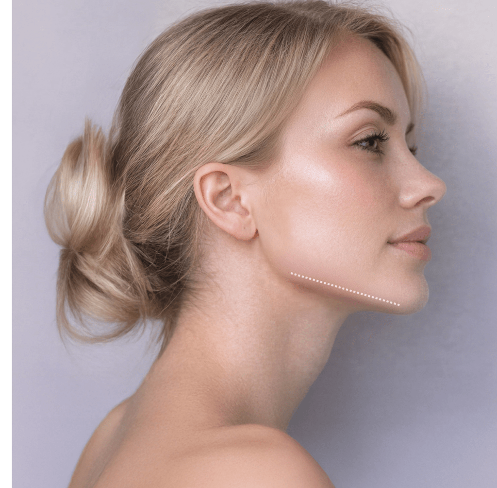 Jawline Contouring: Enhancing Definition Without Surgery
